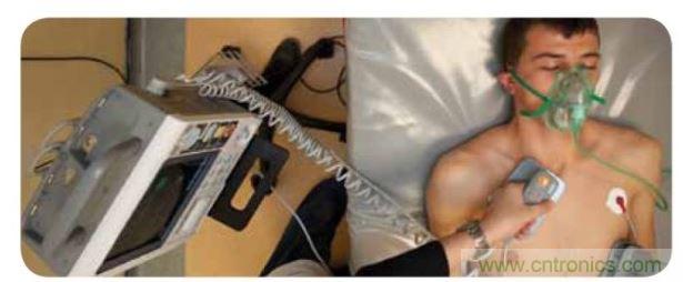 帶電極的醫(yī)院用除顫器。注意，患者身上有外部心電圖或心臟監(jiān)護儀，從胸部的白色圓片(電極)和導(dǎo)聯(lián)(線)可看出來。