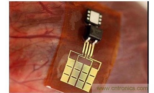 可將人體變成電腦的電子皮膚！