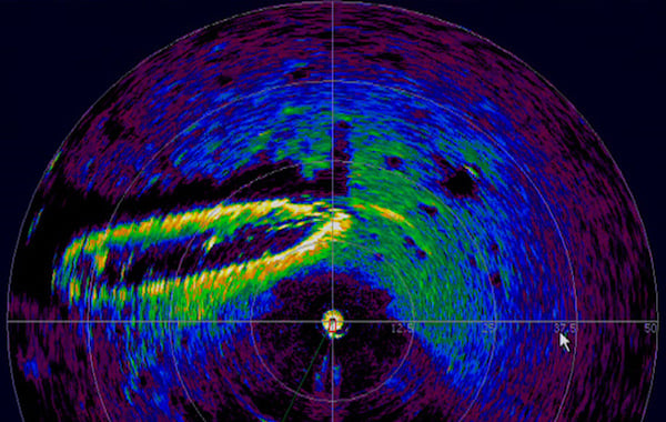 什么是激光雷達(dá)以及如何使用它？