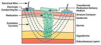  圖5.人體皮膚分層橫截面以及TMD和生物阻抗測(cè)量  考慮到生物阻抗分析的無創(chuàng)性，使用兩個(gè)金屬電極代表電氣傳感器，連接模擬前端(AFE)電路和患者皮膚。這個(gè)金屬與非金屬的接觸點(diǎn)是構(gòu)成整個(gè)電路的另一個(gè)關(guān)鍵部分，連接了AFE和人體電氣模型。電荷載體（電極中的電子和人體內(nèi)的離子）之間的相互作用可能對(duì)這些傳感器的性能產(chǎn)生重大影響，需要根據(jù)每種應(yīng)用進(jìn)行具體考慮。首先，金屬與離子溶液接觸的相互作用導(dǎo)致金屬表面附近溶液中離子濃度的局部變化。這種現(xiàn)象會(huì)改變電極下方區(qū)域的電荷中性，導(dǎo)致金屬周圍的電解質(zhì)電位與溶液其余部分不同，從而在金屬和電解質(zhì)主體之間產(chǎn)生一個(gè)電位差，即常說的“半電池電位”。其次，注入電流的直流分量會(huì)導(dǎo)致電極極化。  表1.各種電極類型和相應(yīng)的半電池電位  金屬及反應(yīng)  半電池電位(V)  Al → Al3+ + 3e- Al → Al3+ + 3e-  –1.706 –1.706  Ni → Ni2+ + 2e- Ni → Ni2+ + 2e-  –0.230 -0.230  H2 → 2H+ + 2e- H2 → 2H+ + 2e-  0.000 (by definition) 0.000（根據(jù)定義）  Ag + Cl- → AgCl + e- Ag + Cl- → AgCl + e-  +0.223 +0.223  Ag → Ag+ + e- Ag → Ag+ + e-  +0.799 +0.799  Au → Au+ + e- Au → Au+ + e-  +1.680 +1.680  這是一種不良現(xiàn)象，往往導(dǎo)致電極性能下降。這些考量表明，電極也需要定義適當(dāng)?shù)碾姎饽Ｐ停▍⒁妶D6）。我們可以將干電極表示為具有三個(gè)串聯(lián)元件的電路：一個(gè)用于模擬半電池電位(EHC)的直流電源；一個(gè)用于模擬金屬和非金屬（人體）之間接觸的RC并聯(lián)電池(Rd||Cd)；以及一個(gè)用于模擬電極金屬的電阻Rs。